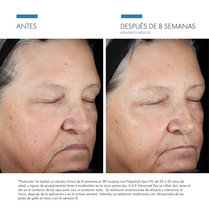 A.G.E Eye Complex